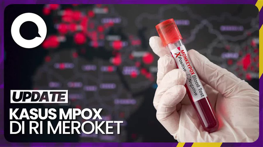 Kasus Cacar Monyet di RI Meroket, Diprediksi Bisa Capai 3.600