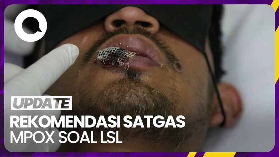 Catat! Ini yang Perlu Dilakukan untuk Tekan Kasus Mpox karena LSL
