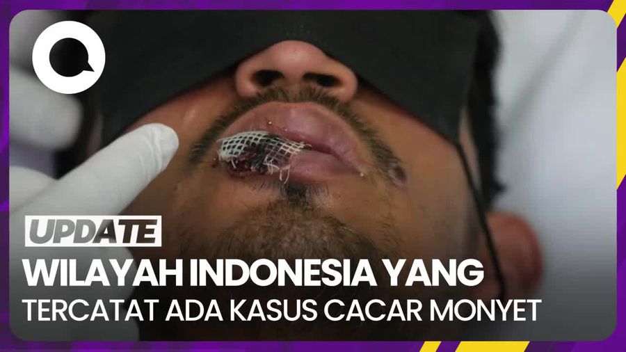 Sebaran Wilayah Kasus Cacar Monyet di Indonesia 