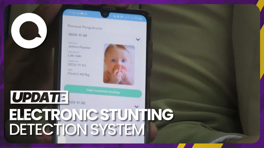Alat Deteksi Stunting Berbasis AI Karya Mahasiswa UGM