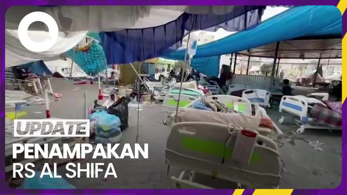 Penampakan RS Al Shifa, Pasien Tidur di Luar dengan Tenda Compang-camping