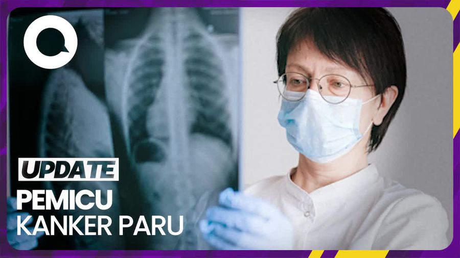 Asap Rokok-Pembakaran Sampah Jadi Pemicu Kanker Paru 