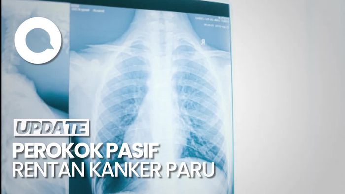 Perokok Pasif Berisiko 4 Kali Lipat Terkena Kanker Paru