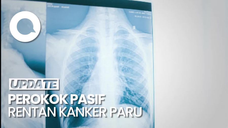 Perokok Pasif Berisiko 4 Kali Lipat Terkena Kanker Paru
