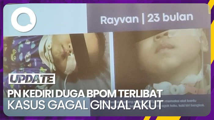 Hasil Sidang PN Kediri Bisa Jadi Bukti Awal Penyidikan Gagal Ginjal Akut