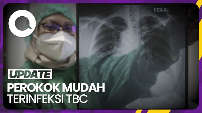 2024 Jepang Wajibkan Tes TBC Pelancong RI gegara Peringkat Kedua Dunia