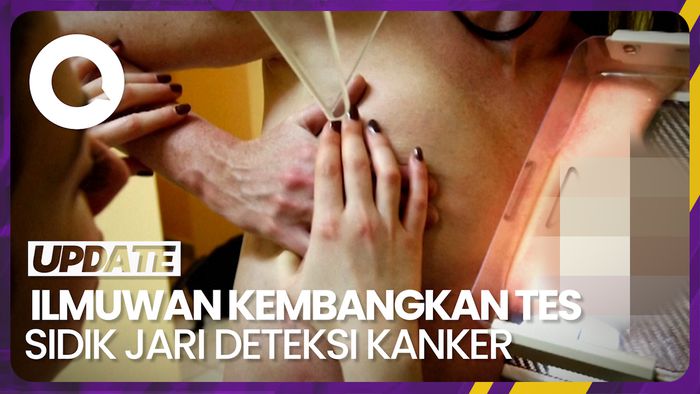 Keringat Ujung Jari Wanita Bisa Bantu Deteksi Kanker Payudara?