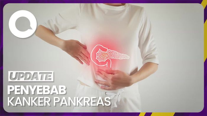Waspada! Gaya Hidup Ini Bisa Sebabkan Kanker Pankreas