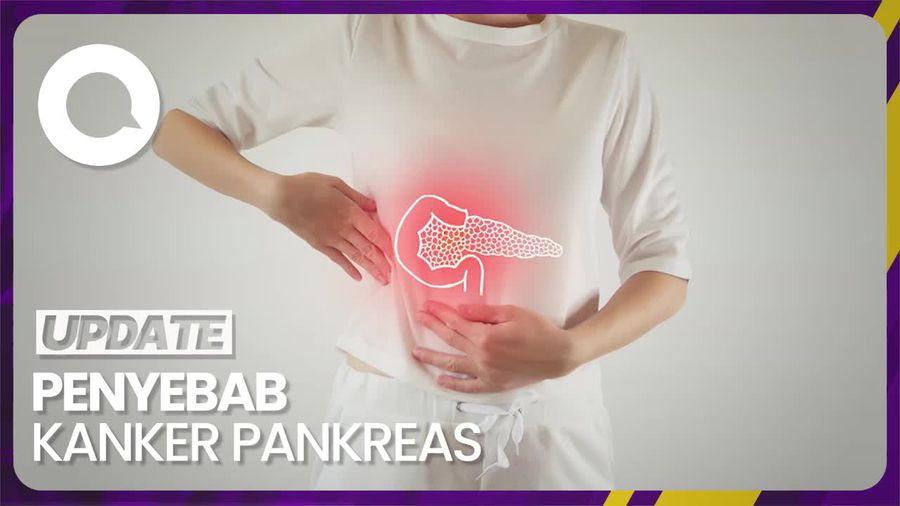 Waspada! Gaya Hidup Ini Bisa Sebabkan Kanker Pankreas