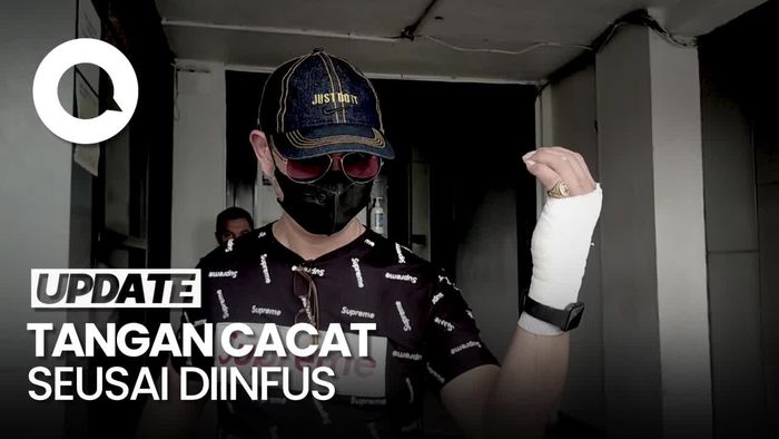 Tangan Warga Palembang Cacat Seusai Diinfus, Polisi Bakal Periksa Pihak RS