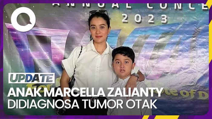 Marcella Zalianty Ceritakan Kondisi Putranya Seusai Didiagnosa Tumor Otak