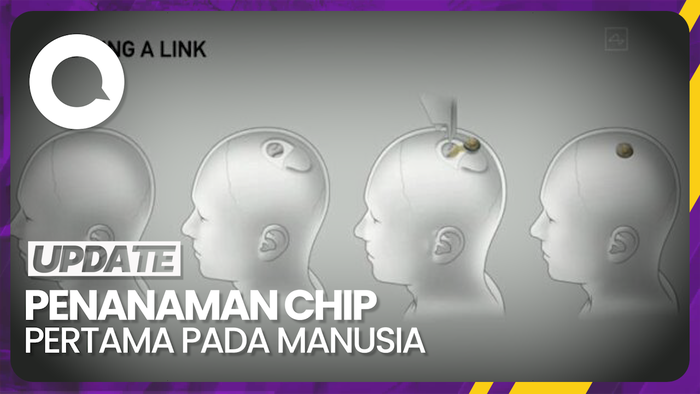 Neuralink Milik Elon Musk Berhasil Tanam Chip ke Manusia