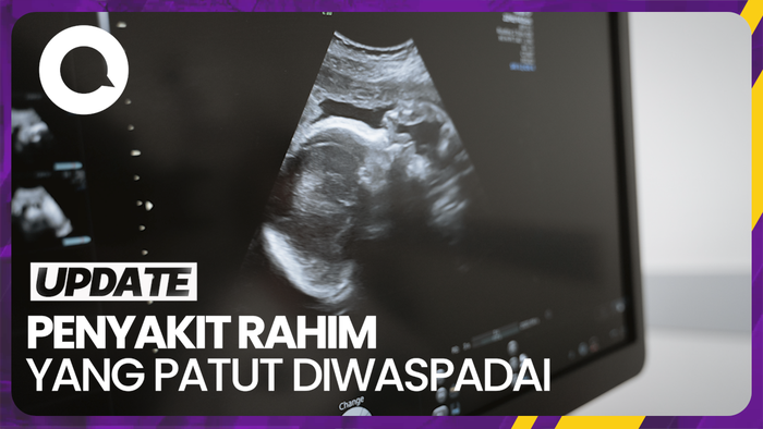 Jenis-jenis Penyakit Rahim yang Harus Diwaspadai Wanita