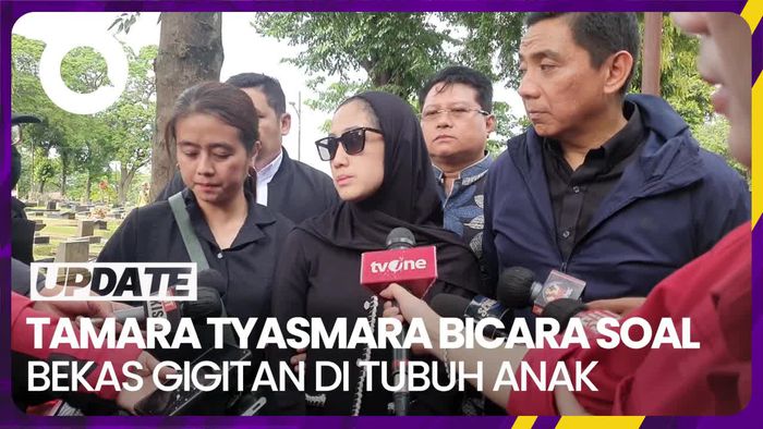 Penjelasan Tamara Tyasmara soal Bekas Gigitan dan Luka Lebam di Tubuh Dante