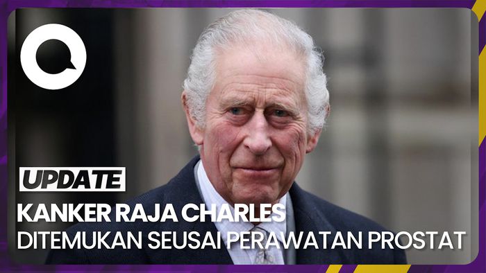 Kanker yang Diidap Raja Charles Ditemukan Seusai Perawatan Prostat 