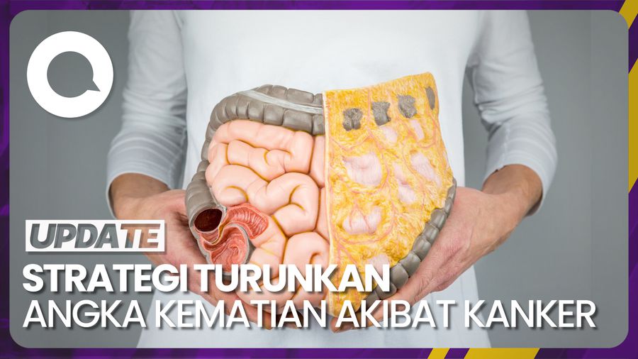 Pentingnya Deteksi Dini untuk Turunkan Angka Kematian Akibat Kanker
