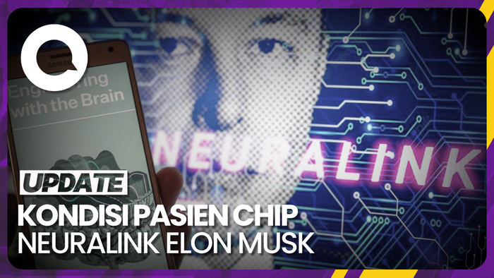 Elon Musk Pamer Kondisi Manusia Pertama yang Ditanamkan Chip Neuralink