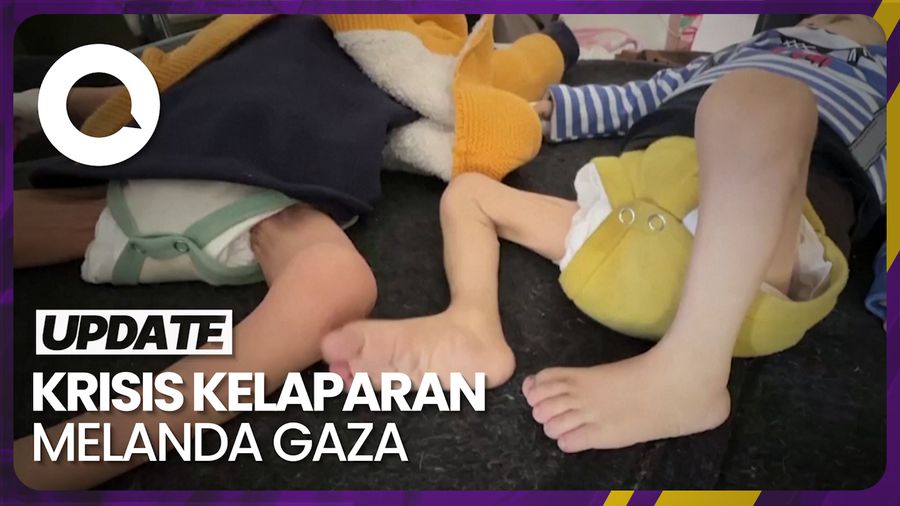 Gaza Makin Memprihatinkan, Anak-anak Alami Malnutrisi