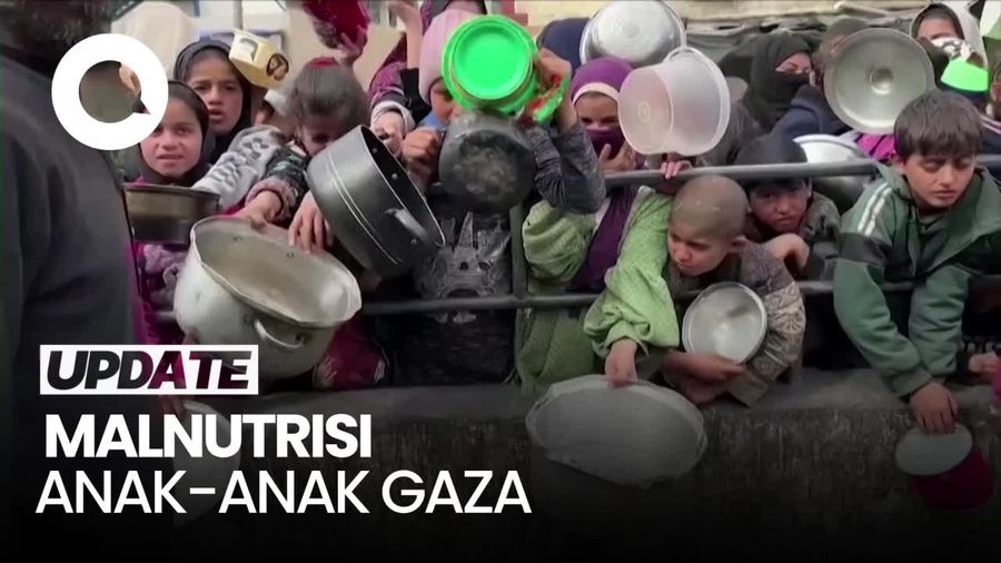 Israel Bikin Anak-anak di Gaza Malnutrisi Bahkan Mencapai Level Ekstrem