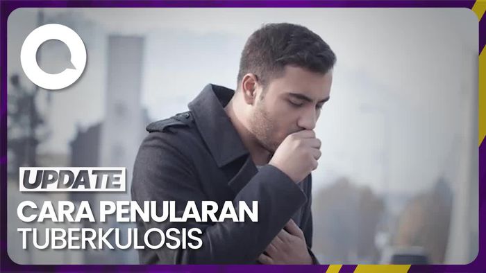 Begini Cara Penularan TBC