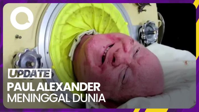 Pria yang Hidup dalam Paru-paru Besi Selama 7 Dekade Tutup Usia