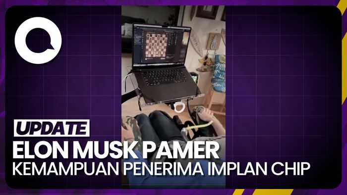 Aksi Pasien Implan Chip Otak Neuralink Gerakkan Komputer Pakai Telepati