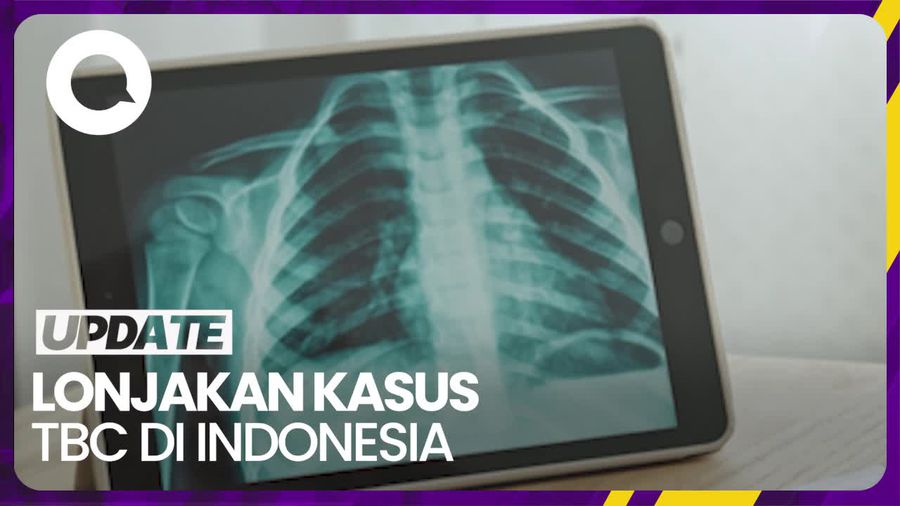Laporan Kemenkes soal Kasus TBC di Indonesia: Terjadi Lonjakan di 2023