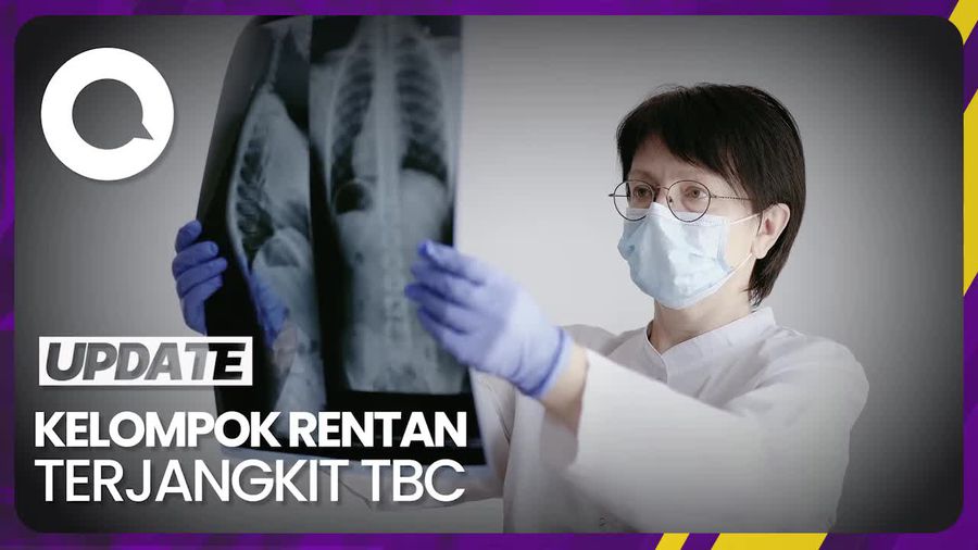 Ini Kelompok yang Rentan Terjangkit TBC