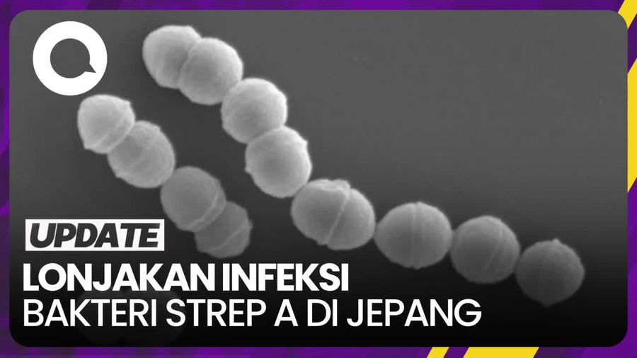 Jepang Waspadai Lonjakan Kasus Infeksi Bakteri Strep A