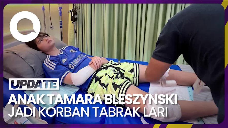 Kabar Terkini Anak Tamara Bleszynski Seusai Jadi Korban Tabrak Lari