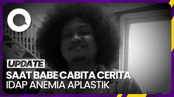 Lihat Lagi Cerita Babe Cabita soal Dirinya Idap Anemia Aplastik