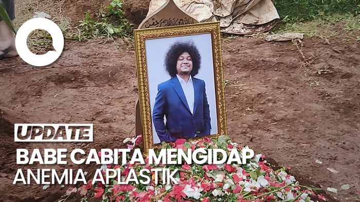 Penyebab Babe Cabita Meninggal Dunia