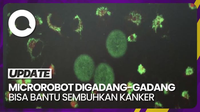Canggihnya Robot yang Digadang-gadang Bisa Bantu Sembuhkan Kanker