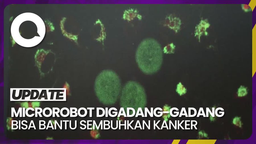Canggihnya Robot yang Digadang-gadang Bisa Bantu Sembuhkan Kanker