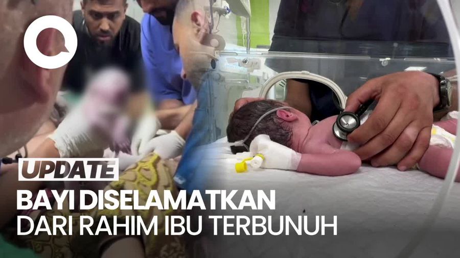 Bayi di Gaza Diselamatkan dari Rahim Ibu yang Terbunuh oleh Israel