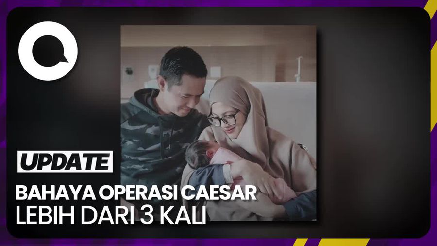Alyssa Soebandono Tiga Kali Operasi Caesar, Dokter Sarankan Tidak Hamil Lagi