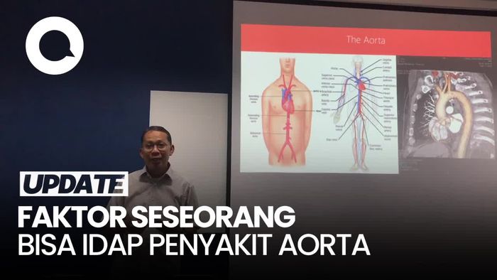 Kenali Faktor Risiko Tinggi Penyakit Aorta