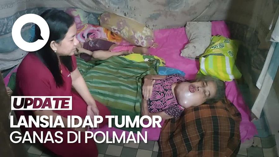 Malangnya Lansia di Polman, Idap Tumor Ganas Tak Punya Biaya Operasi