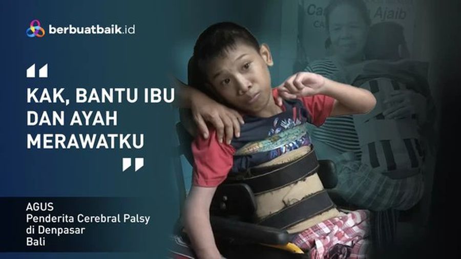 Mimpi Anak Juru Parkir yang Cerebral Palsy untuk Sembuh dan Tak Digunjing