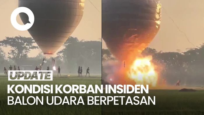Ini Kondisi Remaja Korban Balon Udara Berpetasan yang Meledak di Ponorogo