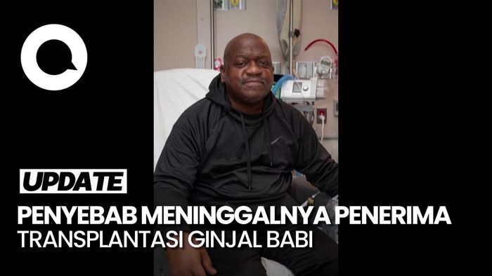 Dokter Tegaskan Kematian Pasien Tak Terkait dengan Transplantasi Ginjal Babi