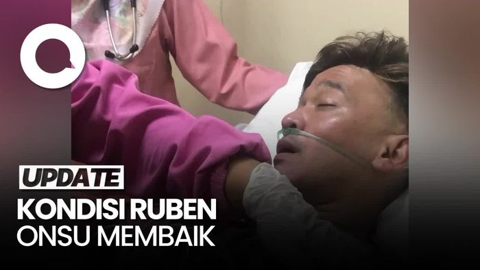 Adik Ungkap Kondisi Ruben Onsu Setelah Dilarikan ke RS di Majalengka