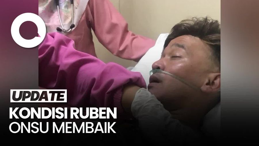 Adik Ungkap Kondisi Ruben Onsu Setelah Dilarikan ke RS di Majalengka