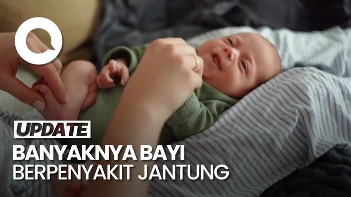 Menkes Sebut 6 Ribu Bayi Meninggal Tiap Tahun Akibat Penyakit Jantung
