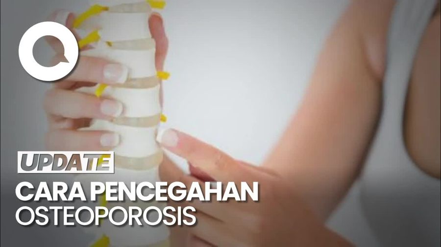Langkah Pencegahan Osteoporosis untuk Tulang Tetap Kuat