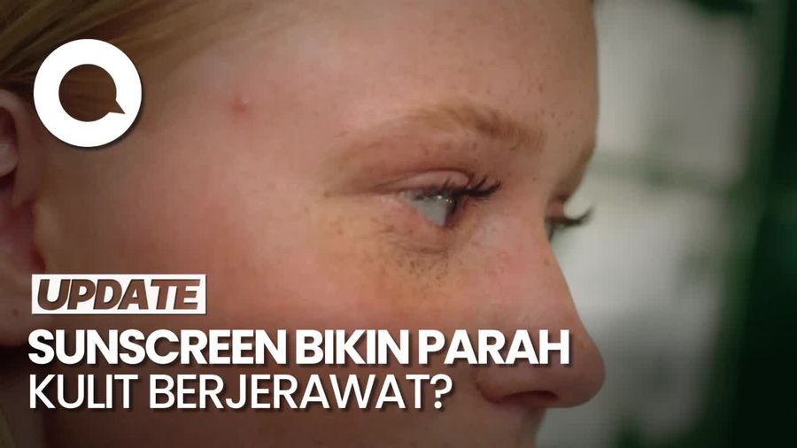 Sunscreen Bikin Jerawat Lebih Parah, Dokter Kulit: Itu Mitos!