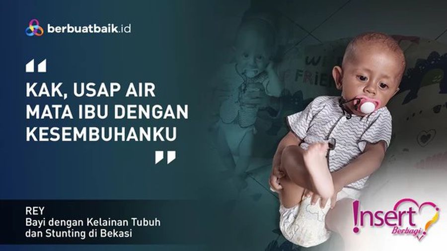 Merana Anak Tukang Somay, Stunting dan BAB dari Ususnya yang Terbuka