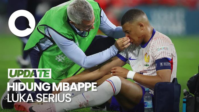 Hidung Mbappe Luka Parah, Deschamps: Dia Dalam Kondisi Buruk