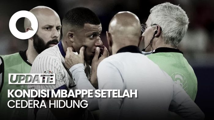 Deschamps Tak Bisa Pastikan Apakah Mbappe Bisa Bermain Lagi di Euro 2024