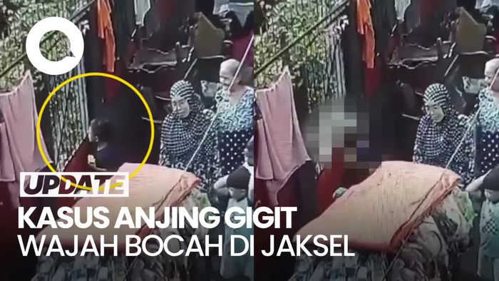 Wajah Bocah di Jaksel Digigit Anjing, Disebut Putus Saraf Mata